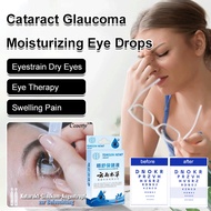 Glaucoma Eye Drops Cataract Eye Drops Eye Drops Moisturizing Glaucoma Cataracts