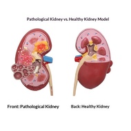 F&H 1.5x Human Kidney Anatomy Model Medical Teaching & Biology Learning Tool Kidney Model with Patho