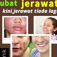 krim putih kulit,krim jerawat baru bontot,jerawat punggung,jerawat belakang,jerawat pasir