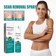 20g Scar Treatment Spray Advance Scar Formula Removal Repair Skin Care Acne Treatment Remove Stretch