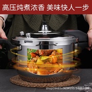 Pressure Cooker 201 304 Stainless Steel Pressure Cooker Household Pot Gas Induction Cooker Multi-Purpose Explosion-Proof Pot