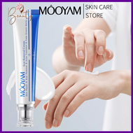 MOOYAM Stretch Mark Surgery Injury Burns Scar Removal Cream Suitable for All Skin Types 30gram