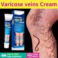 Varicose veins Cream varicose veins for ​legs Veins Treatment Cream ​Earthworm leg Varicosity Phlebi