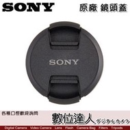 【數位達人】SONY 72mm 原廠鏡頭蓋 ALC-F72S / 保護蓋 原廠鏡頭前蓋 LENS CAP