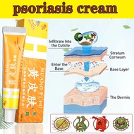 Psoriasis Cream Antifungal cream Herbal Extracts Eczema cream Cream gatal kulit 止癢膏 20g krim gatal k