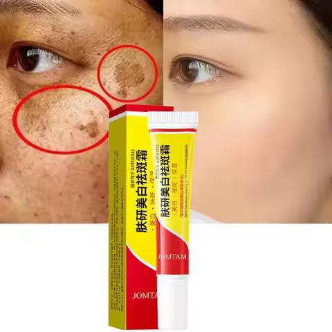 Whitening Freckle Cream Face Brightening Cream Niacinamide Reduce Chloasma Melasma Melanin Fade Fine