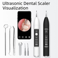 hot【DT】 Ultrasonic Electric Scaler Visual Teeth Whitening With Calculus Tartar Remover Tools Cleaner Stain