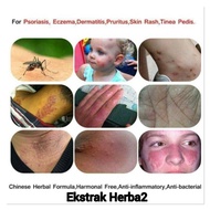 UBAT GATAL MUJARAB / ECZEMA TREATMENT CREAM / UBAT KURAP MUJARAB / ECZEMA HERBAL CREAM / UBAT GATAL 