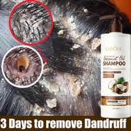Coconut Shampoo Shampoo Kelemumur Shampoo Dandruff Coconut Oil Dandruff Removal Shampoo Oil Control 