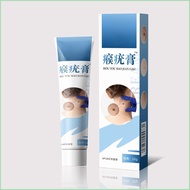 Wart Ointment Antibacterial Cream (non-filament-shaped Soda-like Foot Pad Wart Ointment) Soft Ointme