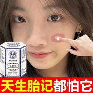 爆卖10w+天生胎记去黑色素去斑点青红胎记咖啡雀斑痣祛斑霜Skin cream for senile plaque, Chinese spot and sun spot freckle essential chloasma freckle 4.8