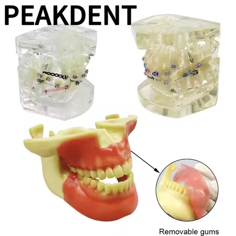 Dental Model With Anchorage Nail Metal Bracket Ortho Teeth Model Transparent Typodont Jaw Restoratio