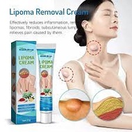 lipoma cream benjolan ubat benjolan lipoma removal cream Removal Multiple Single Lipoma Subcutaneous