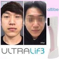 Attibe ULTRALiF 3 家用HIFU機 | 韓國名廠1年免費原廠保養,返老還童 減淡皺紋面部提升&amp;彈性