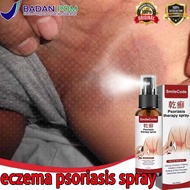 eczema psoriasis spray Anti fungal fungus spray scabies spray antifungal cream krim eczema psoriasis