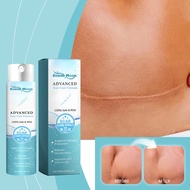 Scar Care Spray Advance Scar Removal Spray Gently Repair Burn Acne Scar and Moisturise The Skin