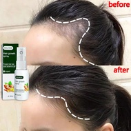 hair tonic growth spray hair essential oil hair tonic growth tonic lebatkan rambut Loss Treatment生發水