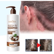 Coconut Shampoo Syampoo kelemumur ubat kepala scalp dandruff kepala psoriasis shampoo itchy scalp tr