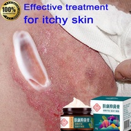 （100% Halal）Eczema cream psoriasis ointment for itchy skin 30g antibacterial cream Herbal Antifungal
