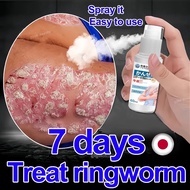 Psoriasis Spray Anti-Itch Eczema Relief Herbal Antifungal Skin Itch Medicine Ringworm Spray Eczema R