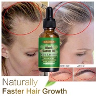 Black Castor Oil Nourish Castor Oil Hair Growth Skin Massage Essential Oil Eyebrows Growth Prevent Skin Aging Castor Organic Serum