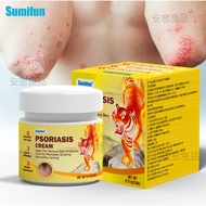 Sumifun 20g Cream eczema Cream Itchy Skin Relief Cream Psoriasis Cream Soothing