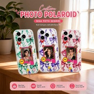 HP Custom Polaroid Photo Case For poco F8 PRO - F8 ULTRA - F7 - F7 PRO - ULTRAF7 - F6 - F5 -F4 -F4 G