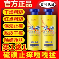 Sulfur Anti-Itching Body Lotion Body Lotion Men Women Autumn Winter Whole Body Dry Skin Lotion Anti-