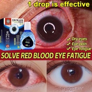 Eye Drops for dry eye Cataract eye drops Eye Wash Care Eye Washer Eye Cleaner Bloodshot Dry Eyes Relieve Eye Fatigue