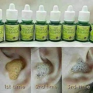 🔥Original🔥Ubat Pencuci Telinga As Syifa Herb Ubat sakit Telinga Titis Telinga , Tahi telinga Keras ,