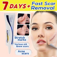 Stretch Mark Cream Scar Removal Cream Peklat Remover Acne Treatment Scar Remover Cream