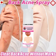 Back Acne Spray 60ml Acne Scar Removal Body Acne for Back Chest Pimple Treatment Spray Relieve Ttchi