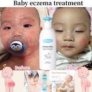 baby wash shampoo baby bath wash 2 in 1 Baby eczema body wash sabun mandi psoriasis body wash Eczema