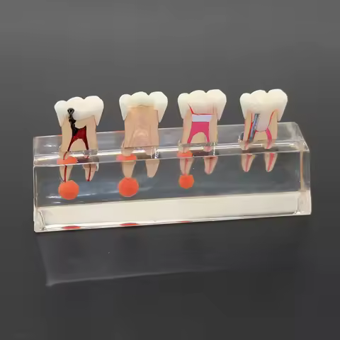 Dental Teeth Model 4-Stage Endodontic Treatment Clear Demonstrates Model for Study Teaching Clinic D