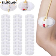 ZILUOLAN Urinary Tube Holders, Adhesive Disposable Catheter Fixation Sticker,  Breathable Catheter S