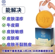 HJT Sabun Herba Anti-radang 宏珏堂 草药消炎香皂 /湿疹 /牛皮藓 (银屑病) /富贵手/ 麻疹/ 痤疮