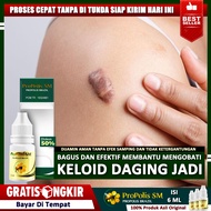 Obat Keloid Menonjol Keloid Daging Tumbuh Keloid Di Dada Keloid Bekas Operasi Keloid Menonjol Di Muk