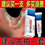 Japan Imported Foot Cream Dedicated Anti-itch Cream Fungus Infection Water Peeling Bad Foot Small Bl