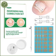 [SH] 1/2 Set Ingrown Toenail Corrector Tools Pedicure Recover Embed Toenail Treatment Professional F