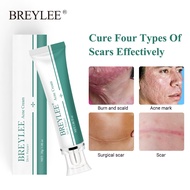 BREYLEE Acne Scar Removal Cream 30g Face Cream Skin Repair