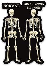 Ehlers-Danlos Syndrome Magnet, Skeleton Comparison Fridge Magnet, EDS Gift