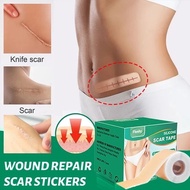 Silicone Scar Sheet Silicone Scar Sheet Fades Scars Silicone Keloid Scar Patch Caesarean Section Sca