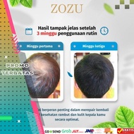 obat penumbuh rambut penumbuh rambut botak serum penumbuh rambut hair