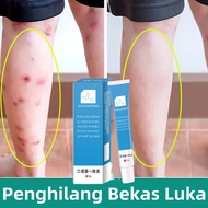 Krim hilangkan parut hitam Hilangkan parut kaki Hilangkan parut kudis parut luka lama mosquito bite 