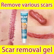 Scar Removal Cream Acne Scar Treatment Remove Scars Foot Scar Removal Cream Scar Paste
