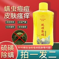 佰束硫磺除螨皂液硫磺除螨沐浴露去油去除驱螨虫硫磺皂液洗澡硫磺皂洗澡沐浴露除螨 1瓶装