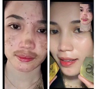 PAKET LENGKAP CREAM GLOWING JS SKINCARE BEAUTY