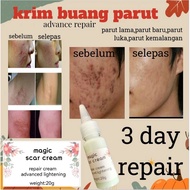 Scar removal cream, scar removal,/clear, scary, beautiful skin, acne scar ointment, scary cream, sca