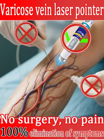 Generation Varicose Vein 3nd Laser Pointer Treatment Laser Eliminates Vasculitis and Phlebitis Relie