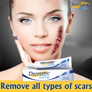 Original DERMATIX Ultra advance scar Remover gel 15g dermatix Ultra Scar Remover for old scar on leg
